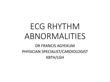 ECG RHYTHM ABNORMALITIES
