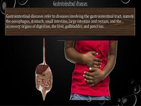 Gastroesophageal Reflux Disease affecting the upper gastrointestinal tract. 10% of the population experience Heartburn is the cardinal symptom.