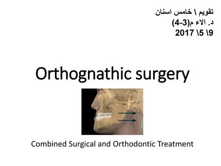 Combined Surgical and Orthodontic Treatment