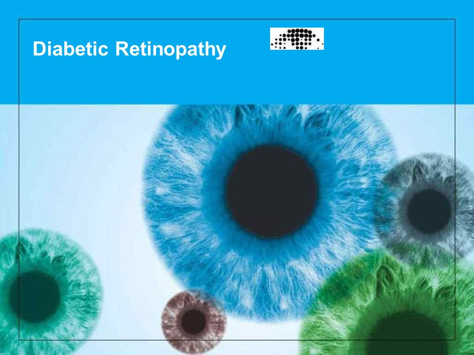 diabetic retinopathy ppt