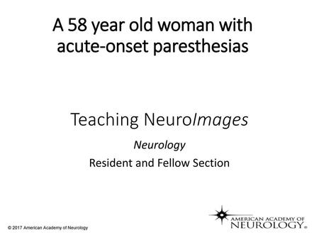 A 58 year old woman with acute-onset paresthesias