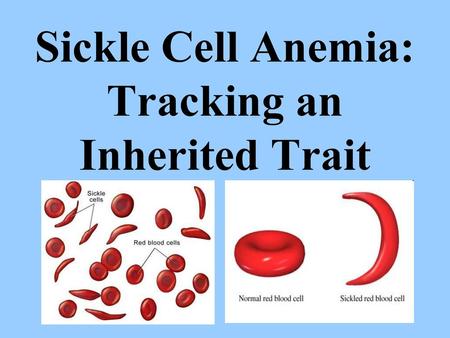 Sickle Cell Anemia: Tracking an Inherited Trait