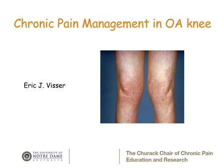 Chronic Pain Management in OA knee