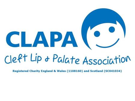 Hi everybody! I’m here from a charity called the Cleft Lip and Palate Association and I’d like to talk to you about little boys and girls just like you.