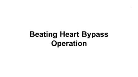 Beating Heart Bypass Operation
