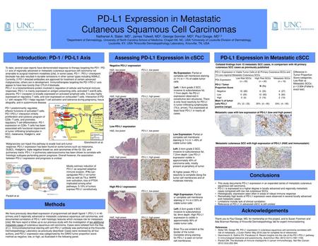 PD-L1 Expression in Metastatic Cutaneous Squamous Cell Carcinomas Nathaniel A. Slater, MD1, James Tidwell, MD2, George Sonnier, MD2, Paul Googe, MD1,3.