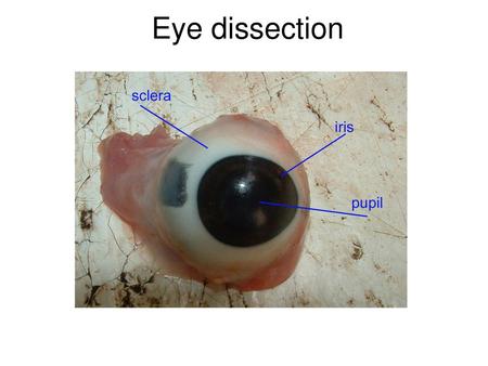Eye dissection.