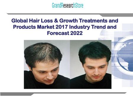 Report Description The Global Hair Loss & Growth Treatments and Products Market 2015 Industry Trend and Forecast 2020 is a professional and in-depth study.