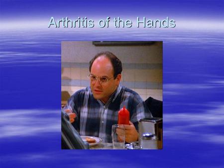 Arthritis of the Hands.