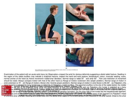 Examination of the patient with an acute wrist injury (a) Observation—inspect the wrist for obvious deformity suggesting a distal radial fracture. Swelling.