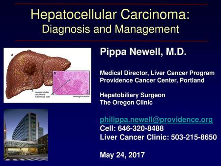 Hepatocellular Carcinoma: Diagnosis and Management