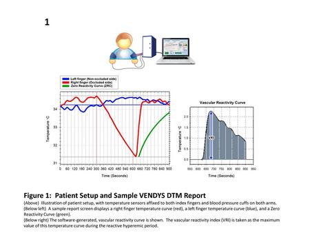 1 Figure 1: Patient Setup and Sample VENDYS DTM Report