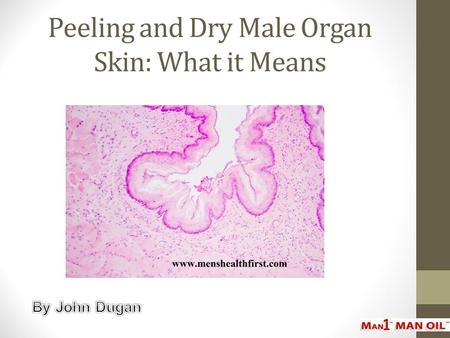 Peeling and Dry Male Organ Skin: What it Means