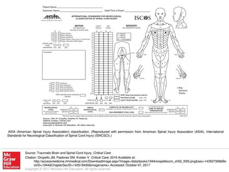ASIA (American Spinal Injury Association) classification