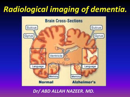 Radiological imaging of dementia.