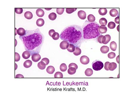 Acute Leukemia Kristine Krafts, M.D..