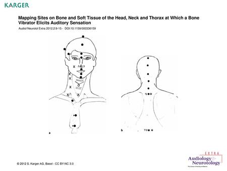 Mapping Sites on Bone and Soft Tissue of the Head, Neck and Thorax at Which a Bone Vibrator Elicits Auditory Sensation Audiol Neurotol Extra 2012;2:9-15.