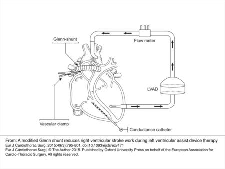 Figure 1: Animal preparation; a modified Glenn shunt was created between the SVC and the main pulmonary artery. A left ventricular assist device was implanted.