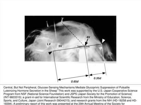 Figure 1. Lateral radioventriculograph showing the location of the fourth ventricle in a sheep and determination of the target for fourth ventricular cannulation.