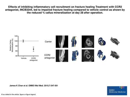 Effects of inhibiting inflammatory cell recruitment on fracture healing Treatment with CCR2 antagonist, INCB3344, led to impaired fracture healing compared.