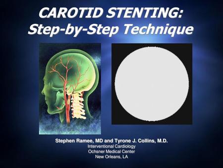CAROTID STENTING: Step-by-Step Technique