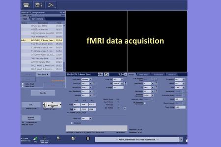 FMRI data acquisition.