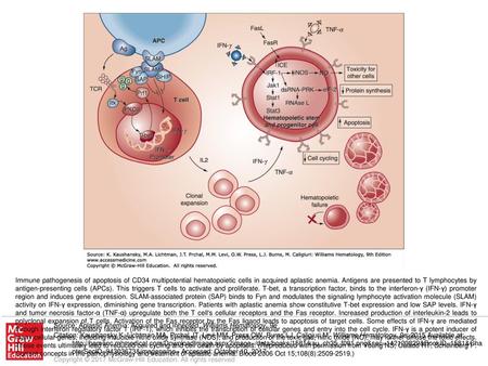 Immune pathogenesis of apoptosis of CD34 multipotential hematopoietic cells in acquired aplastic anemia. Antigens are presented to T lymphocytes by antigen-presenting.