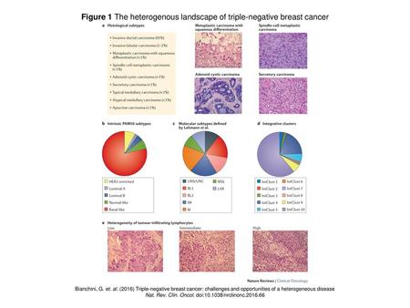 Figure 1 The heterogenous landscape of triple-negative breast cancer