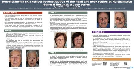 Non-melanoma skin cancer reconstruction of the head and neck region at Northampton General Hospital: a case series. Iqbal U1, Kapasi F2 Ameerally P3 1.