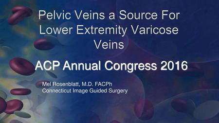 Pelvic Veins a Source For Lower Extremity Varicose Veins