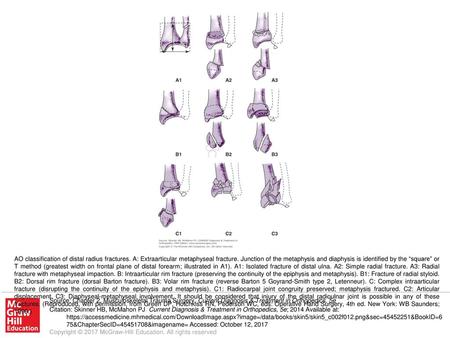 AO classification of distal radius fractures