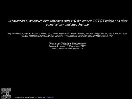 Localisation of an occult thyrotropinoma with 11C-methionine PET-CT before and after somatostatin analogue therapy  Olympia Koulouri, MRCP, Andrew C Hoole,