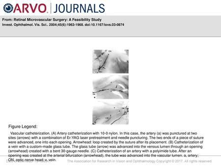 From: Retinal Microvascular Surgery: A Feasibility Study