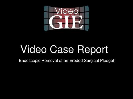 Endoscopic Removal of an Eroded Surgical Pledget