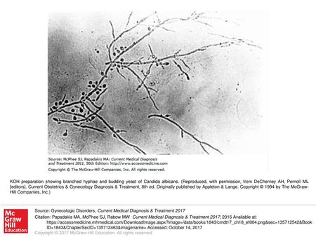 KOH preparation showing branched hyphae and budding yeast of Candida albicans. (Reproduced, with permission, from DeCherney AH, Pernoll ML [editors]. Current.