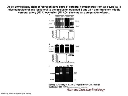 A: gel zymography (top) of representative pairs of cerebral hemispheres from wild-type (WT) mice contralateral and ipsilateral to the occlusion obtained.