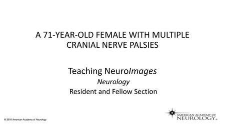 A 71-YEAR-OLD FEMALE WITH MULTIPLE CRANIAL NERVE PALSIES