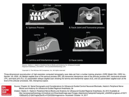 Three-dimensional reconstruction of high-resolution computed tomography scan data set from a lumbar training phantom (CIRS Model 034, CIRS Inc., Norfolk,