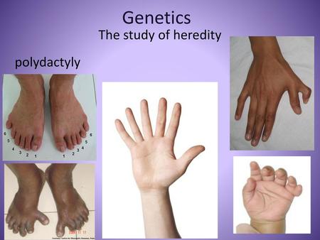 Genetics The study of heredity polydactyly.