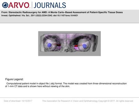 From: Stereotactic Radiosurgery for AMD: A Monte Carlo–Based Assessment of Patient-Specific Tissue Doses Invest. Ophthalmol. Vis. Sci.. 2011;52(5):2334-2342.