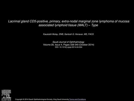 Lacrimal gland CD5-positive, primary, extra-nodal marginal zone lymphoma of mucosa associated lymphoid tissue (MALT) – Type  Kaustubh Mulay, DNB, Santosh.