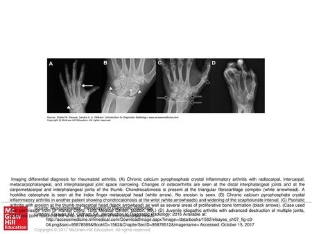 Imaging differential diagnosis for rheumatoid arthritis