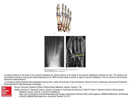 (c) Imaging in Sports-Specific Musculoskeletal Injuries 2016, p