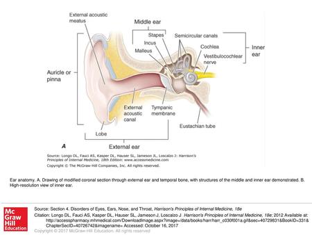 Ear anatomy. A. Drawing of modified coronal section through external ear and temporal bone, with structures of the middle and inner ear demonstrated. B.