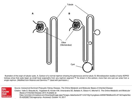 Illustration of the origin of tubular cysts