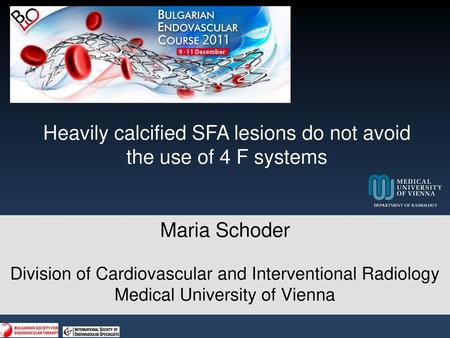 Heavily calcified SFA lesions do not avoid the use of 4 F systems