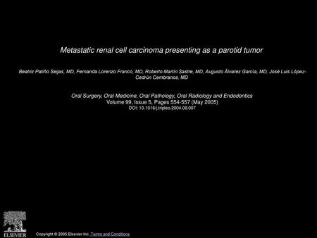 Metastatic renal cell carcinoma presenting as a parotid tumor