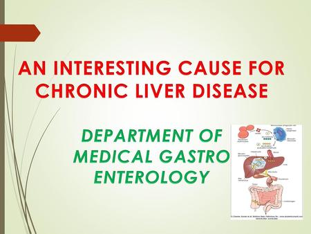 AN INTERESTING CAUSE FOR CHRONIC LIVER DISEASE
