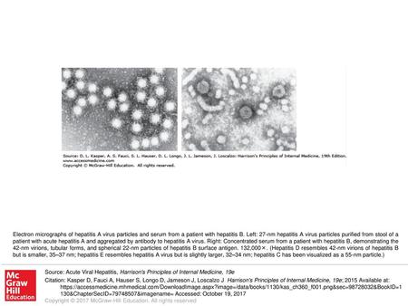 Electron micrographs of hepatitis A virus particles and serum from a patient with hepatitis B. Left: 27-nm hepatitis A virus particles purified from stool.