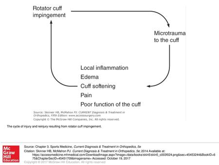 The cycle of injury and reinjury resulting from rotator cuff impingement. Source: Chapter 3. Sports Medicine, Current Diagnosis & Treatment in Orthopedics,